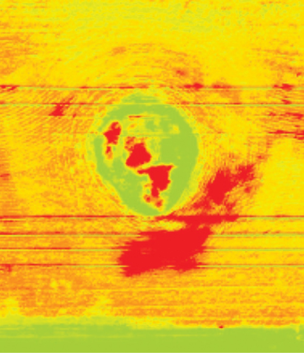 In this digital image of a pea crop, the green area shows a depression where weeds flourished.