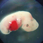This is an image of a four-week old chimera — a pig embryo that has been implanted with human stem cells. The objective of this biotechnology is to determine if scientists might one day be able to use pigs as hosts to produce human organs that eventually will be harvested and used in human organ transplant programs.