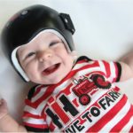 Because of a concerned blog reader, our baby was diagnosed and had
surgery for a rare skull disorder.