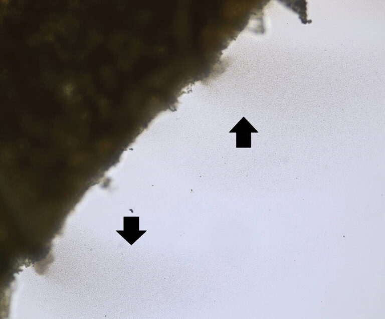 Top tips for managing bacterial leaf streak Grainews