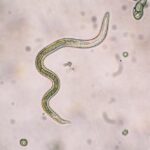File photo of a roundworm larva. (Dotana/iStock/Getty Images)