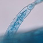 Syngenta rolls out Envita Dry nitrogen-fixing biological