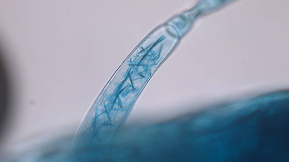 Envita product entering plant through leaf hair. Pic: Azotic